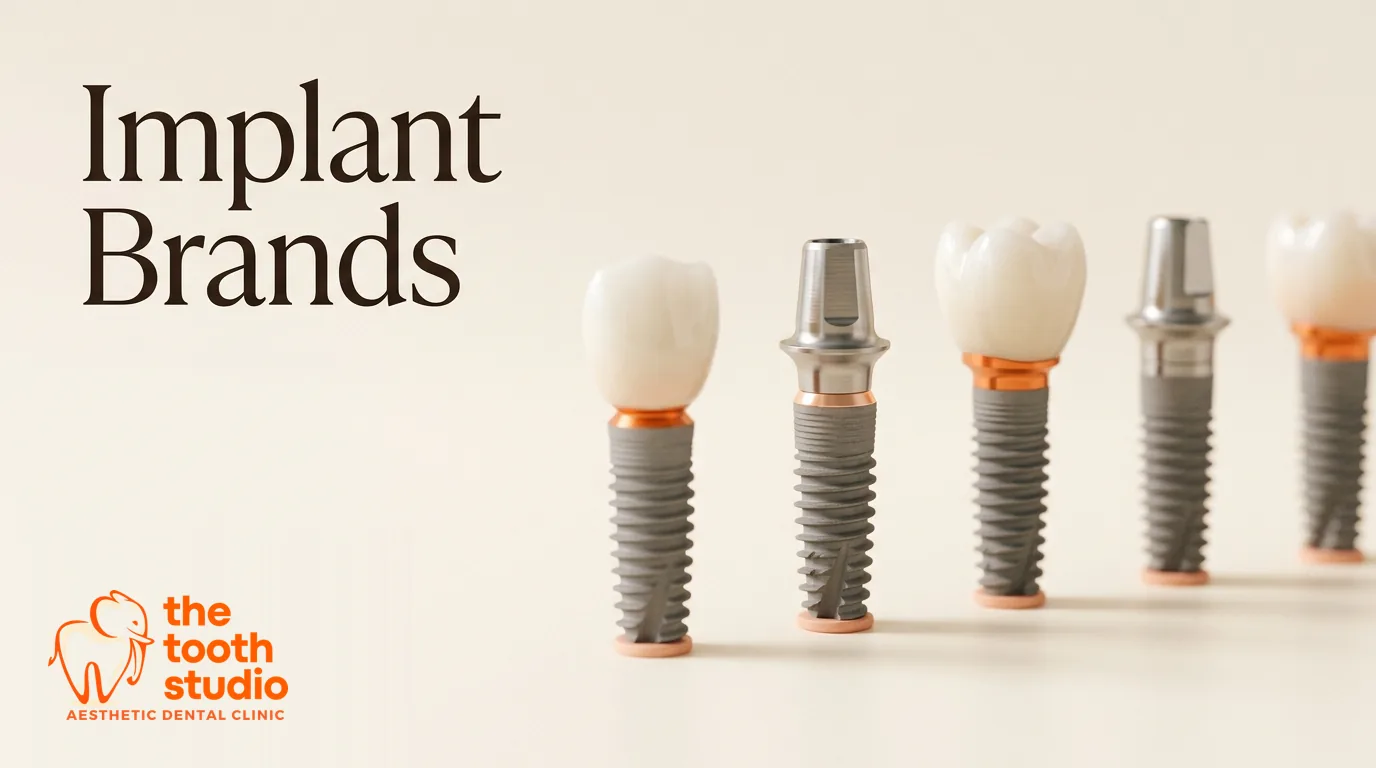 Dental Implant Brands: Do They Really Matter? - The Tooth Studio, Kukatpally Hyderabad