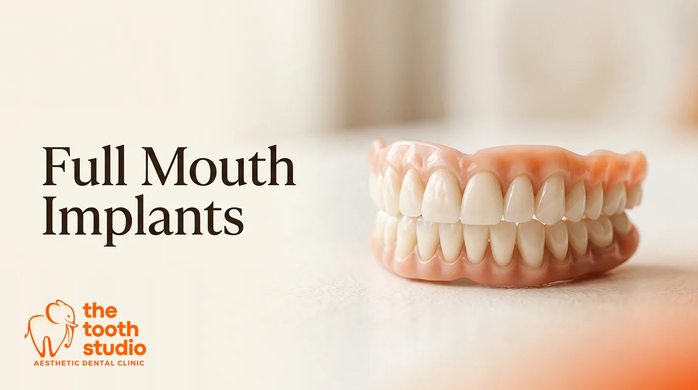Full Mouth Dental Implants: Your Options Explained - The Tooth Studio, Kukatpally Hyderabad