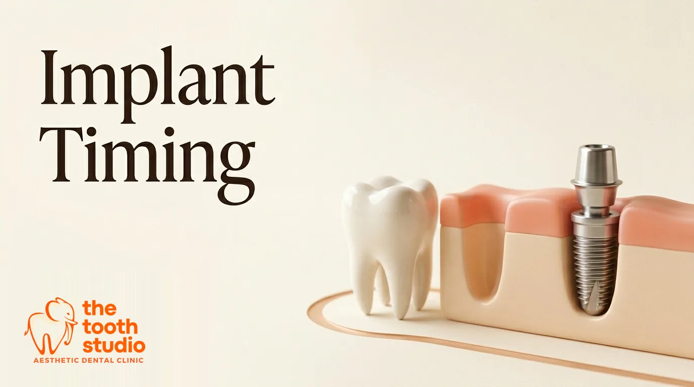 Dental Implant After Extraction: How Long Should You Wait? - The Tooth Studio, Kukatpally Hyderabad