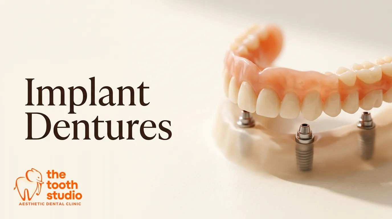 Implant-Supported Dentures (Overdentures): A Complete Guide - The Tooth Studio, Kukatpally Hyderabad