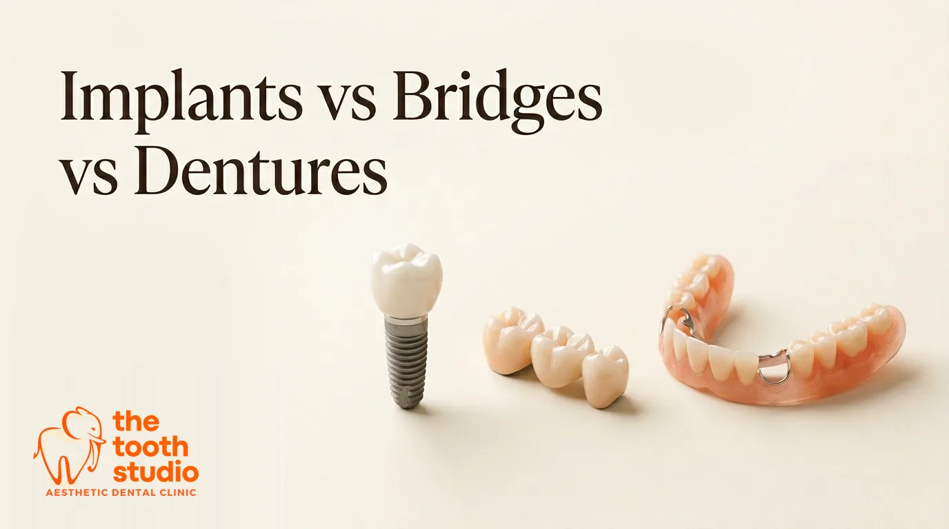 Implants vs Bridges vs Dentures: Which Is Best? - The Tooth Studio, Kukatpally Hyderabad