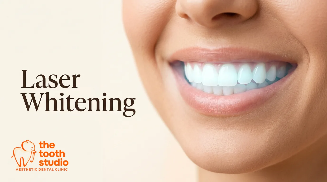 Laser Teeth Whitening: How It Works - The Tooth Studio, Kukatpally Hyderabad