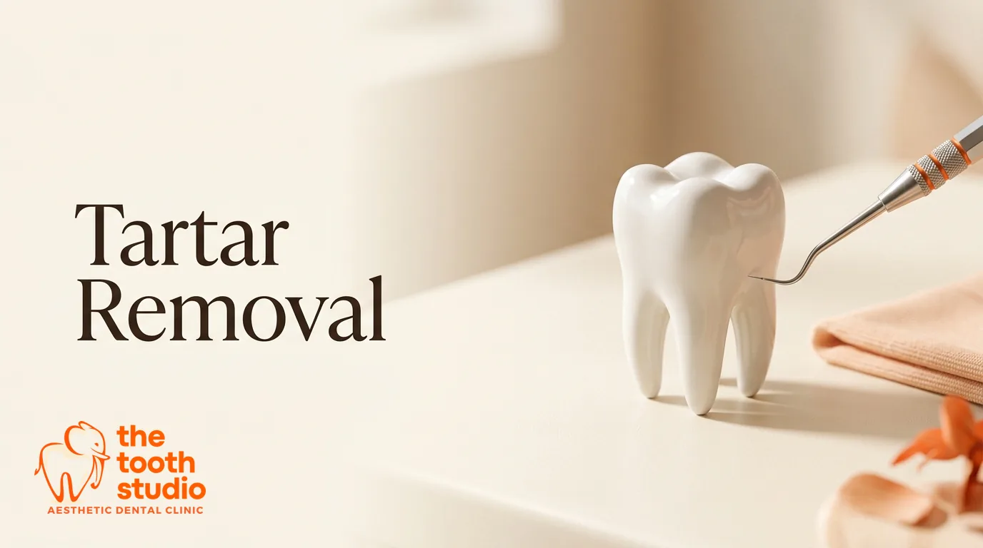 Tartar: Why It Forms and How It's Removed - The Tooth Studio, Kukatpally Hyderabad