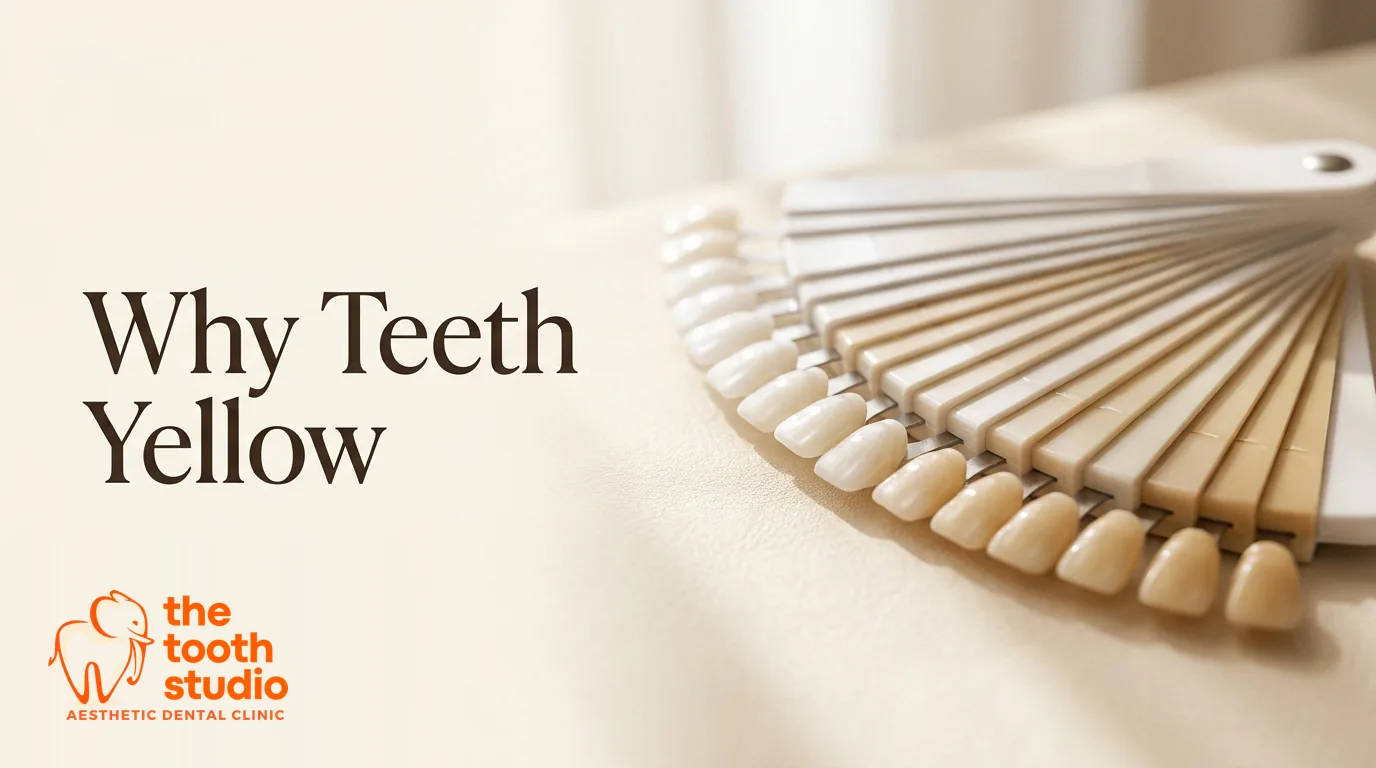 Why Are My Teeth Yellow? Causes and Real Solutions - The Tooth Studio, Kukatpally Hyderabad
